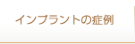 インプラントの症例